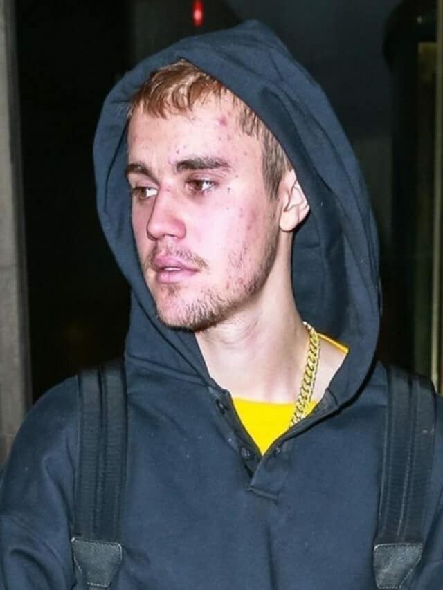 Justin Bieber shares  latest info about his facial paralysis